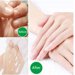 Aliver Hand Moisturizing Gloves for Repair Dry Cracked Skin