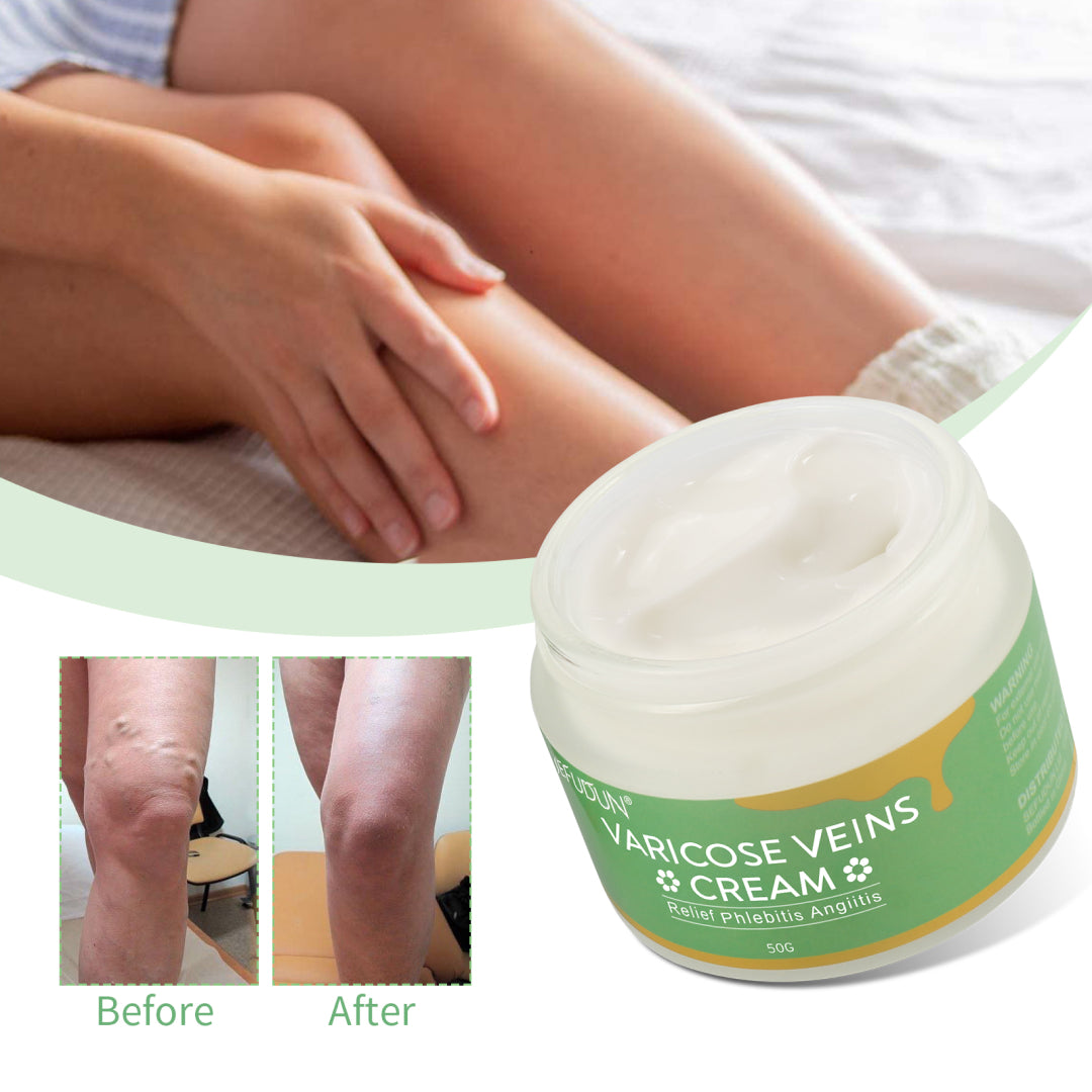 SEFUDUN Varicose Veins Cream, 50g