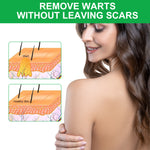 ALIVER Body Skin Tag & Wart Remover Ointment, 20g