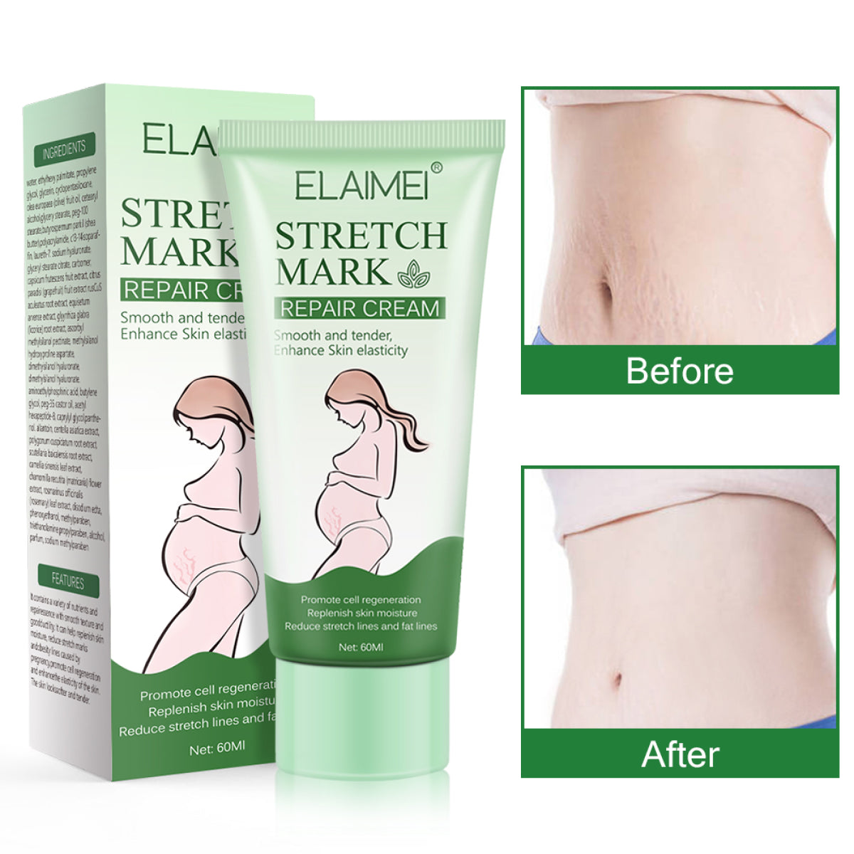 ELAIMEI Anti Stretch Mark Cream, 60ml