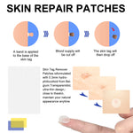 ELAIMEI 2in1 Fast & Effective Skin Tag Remover Kit