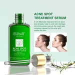 ELBBUB Acne Spot Treatment Serum, Tea Tree, 17ml