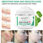 Aliver Treatment Scar Remove Cream for Body Face Skin
