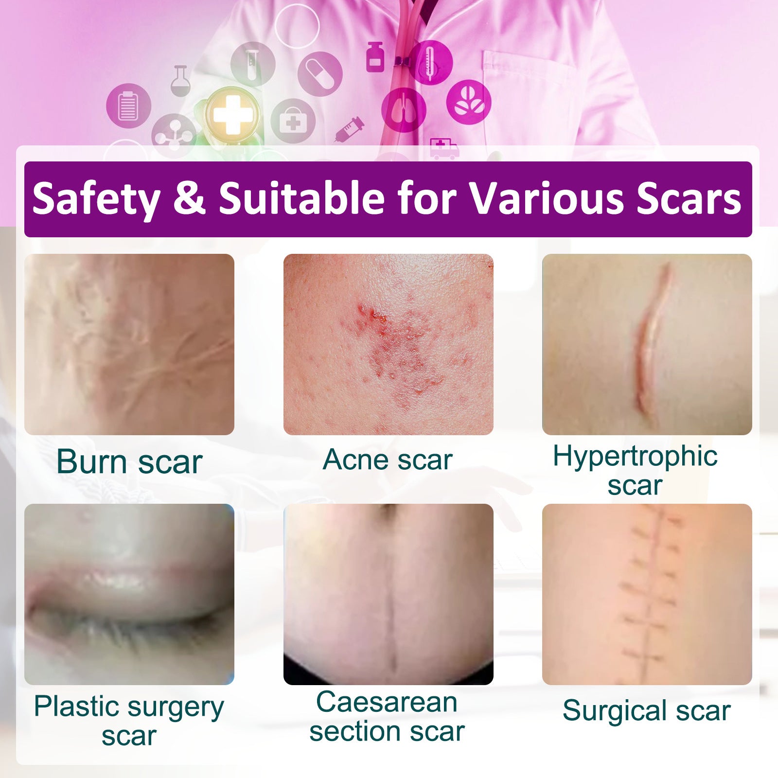 Elaimei Silicone Scar Removal Gel Tape Roll for Skin Treatment Repair 1.5 m
