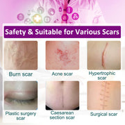 Elaimei Silicone Scar Removal Gel Tape Roll for Skin Treatment Repair 1.5 m