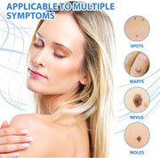 SEFUDUN Skin Tag & Wart Removal Cream, 20g