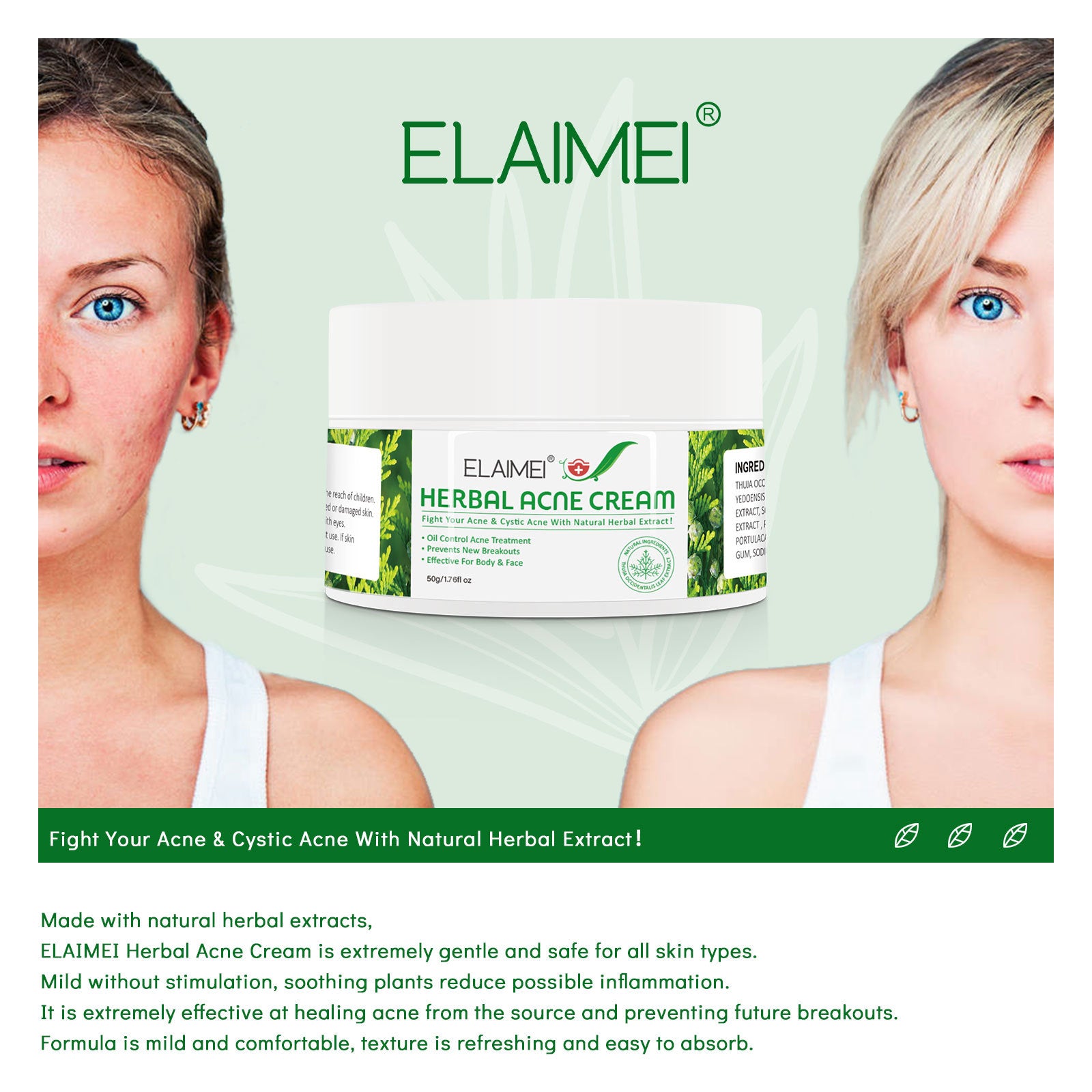 ELAIMEI Herbal Acne Treatment Cream, 50g