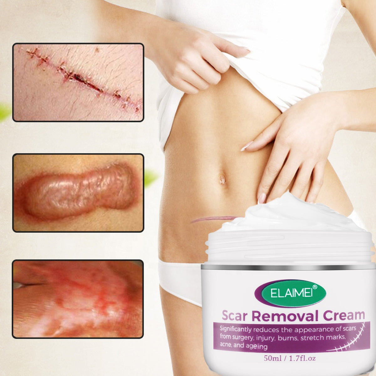ELAIMEI Advanced Scar Removal Cream, 50ml