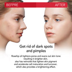 ALIVER Pure Rosehip Oil for Hair, Face & Body, 60ml