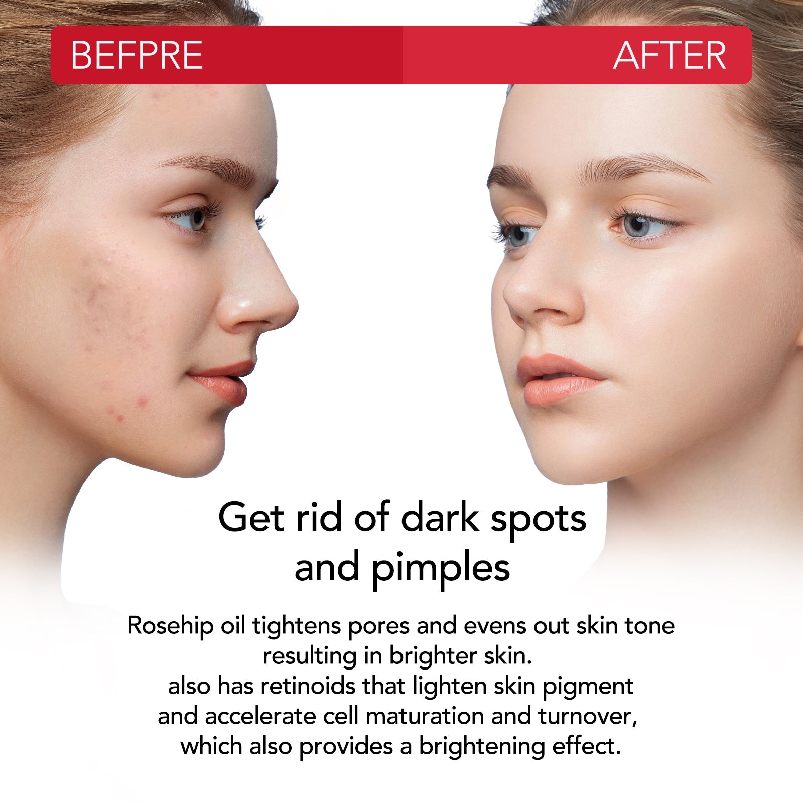 ALIVER Pure Rosehip Oil for Hair, Face & Body, 60ml