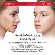 ALIVER Pure Rosehip Oil for Hair, Face & Body, 60ml