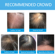 ELAIMEI Hair Loss Building Fibers, 27.5 g (Dark Brown)