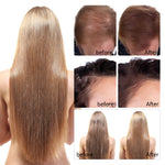 PEGCIZ Scalp Serum for Hair Growth, 30ml