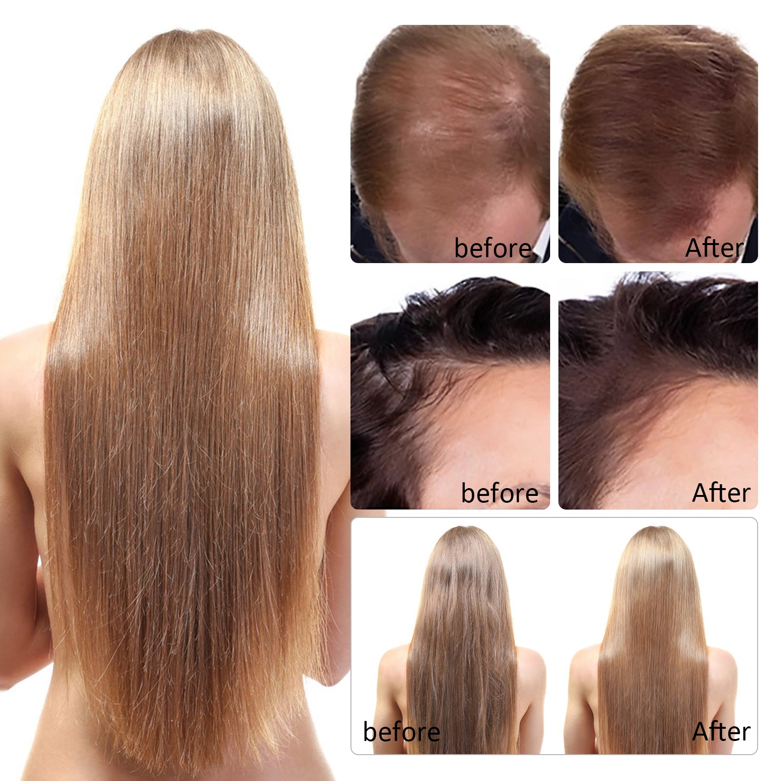 PEGCIZ Scalp Serum for Hair Growth, 30ml