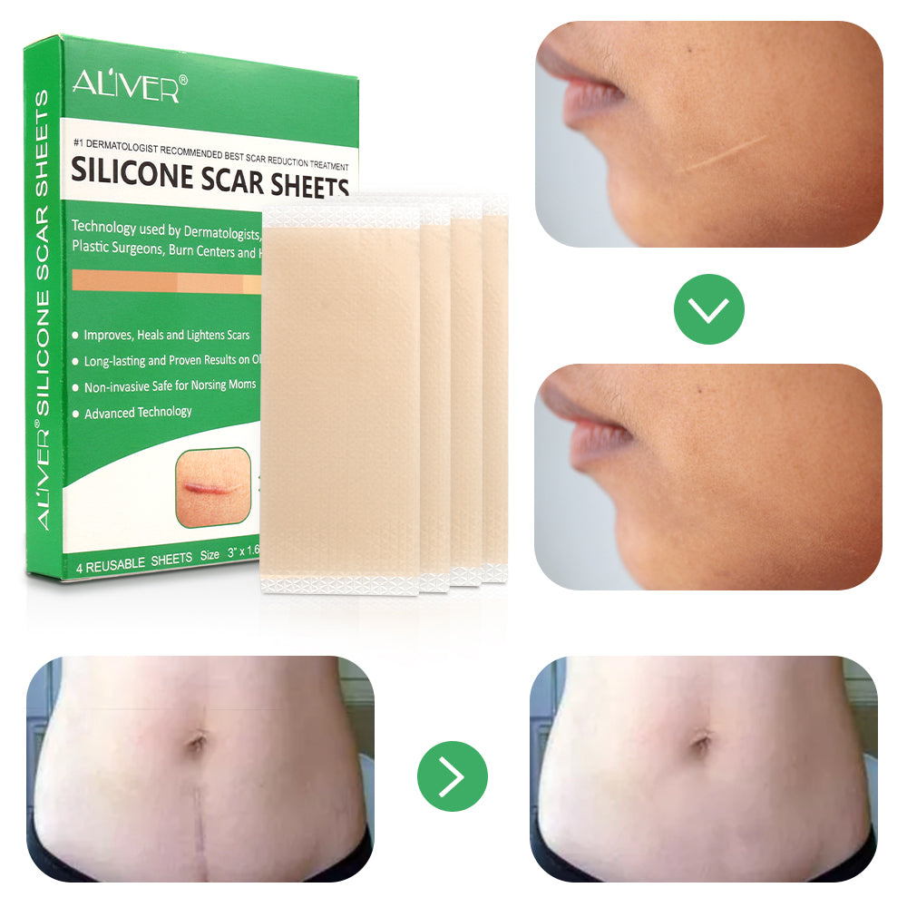 ALIVER Silicone Scar Sheets, Reduction Treatment, pack of 4pcs