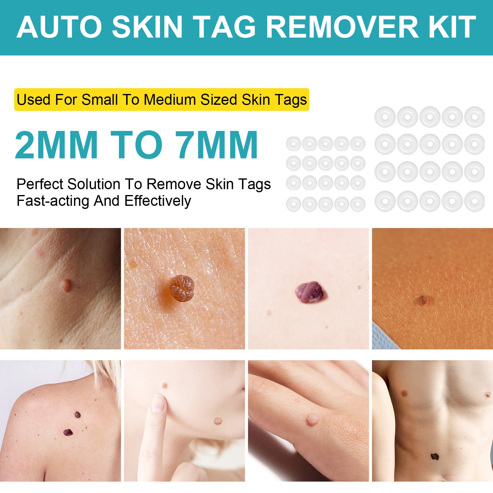 ELAIMEI 2in1 Fast & Effective Skin Tag Remover Kit