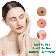 ELAIMEI Natural Skin Tag & Wart Remover Cream, 20g