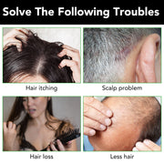 ALIVER Jamaican Black Castor Hair Growth Shampoo, 300ml