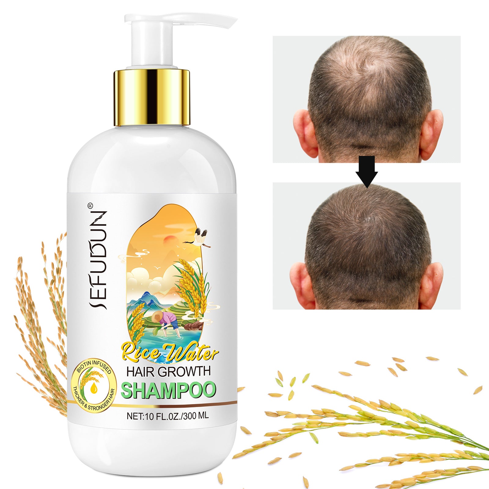 SEFUDUN Rice Water Hair Growth Shampoo, 300ml