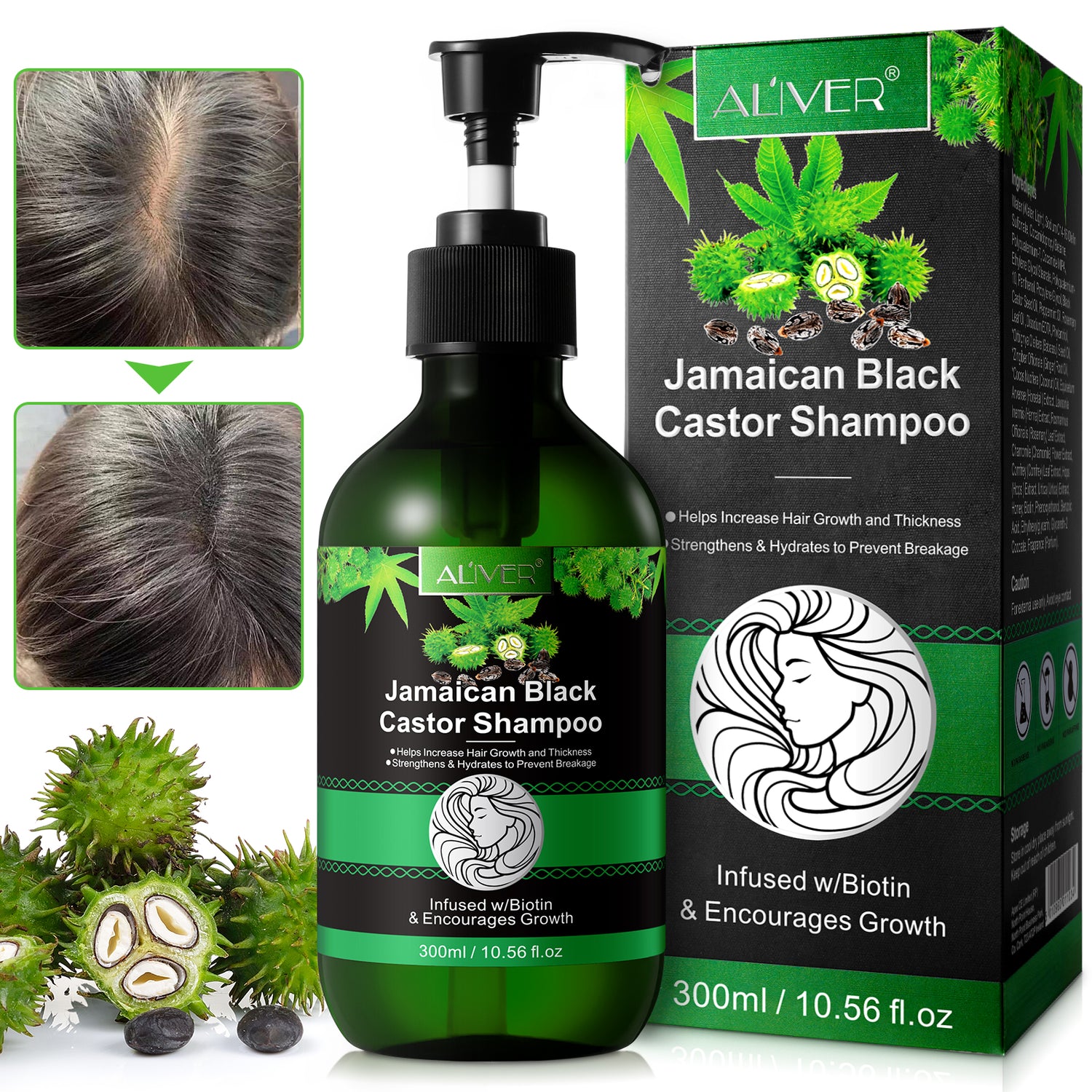 ALIVER Jamaican Black Castor Hair Growth Shampoo, 300ml