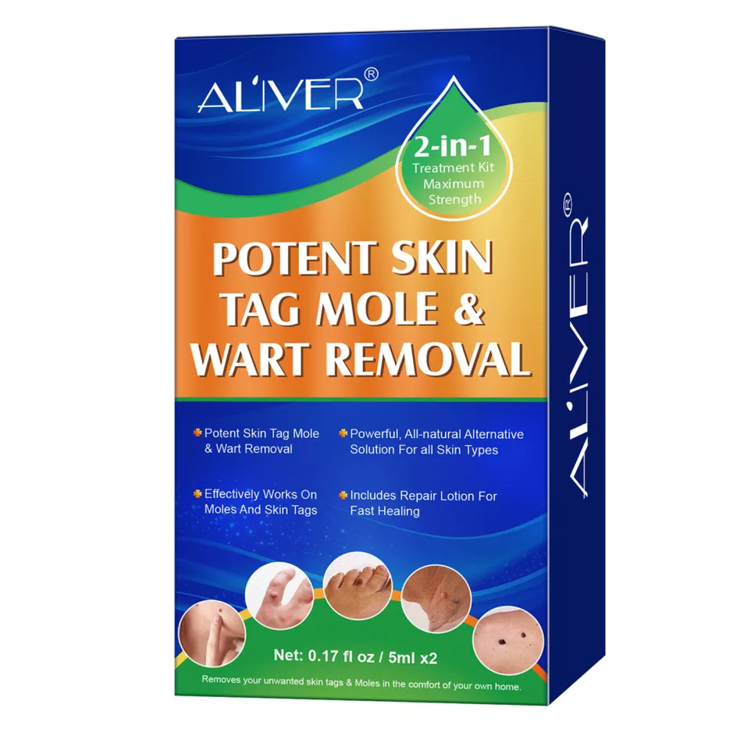 ALIVER 2in1 Effective Body Skin Tag Mole & Wart Removal Kit