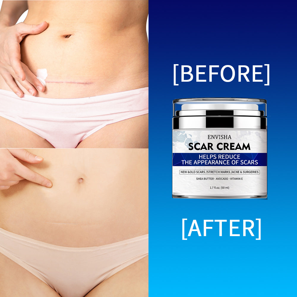 ENVISHA Scar Removal Cream, 50ml