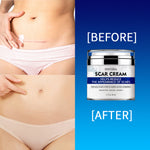 ENVISHA Scar Removal Cream, 50ml