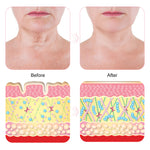 PEGCIZ Anti Wrinkle Decollete & Neck Pads, pack of 2pcs