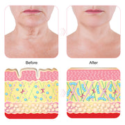 PEGCIZ Anti Wrinkle Decollete & Neck Pads, pack of 2pcs