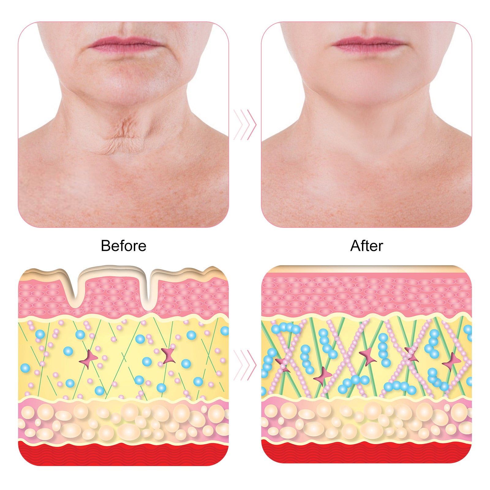 PEGCIZ Anti Wrinkle Decollete & Neck Pads, pack of 2pcs