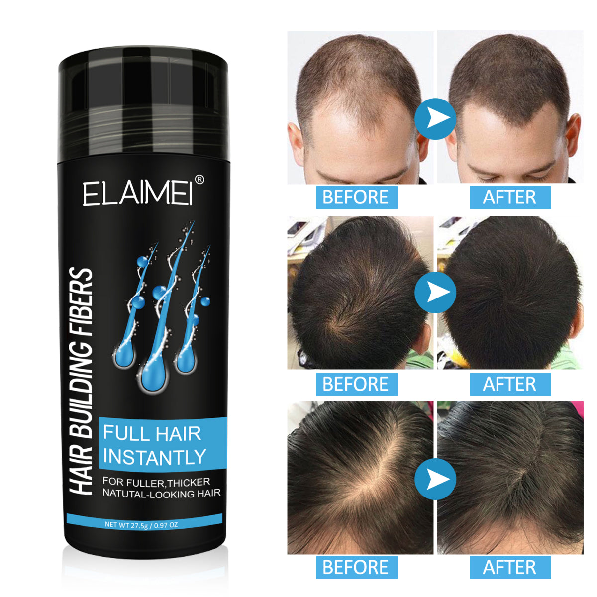 ELAIMEI Hair Loss Building Fibers, 27.5 g (Medium Brown)