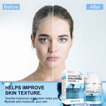 Kizenka Hyaluronic Acid Face Cream Moisturizing Anti Aging Wrinkle Remover Repair Skin Care Retinol Fine Line Repair Niacinamide Day Night