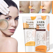 ELAIMEI Dark Spot Corrector, Whitening Skin Cream 60ml