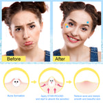 ELAIMEI Stars + Round Pimple Patches, pack of 126pcs (yellow, blue)