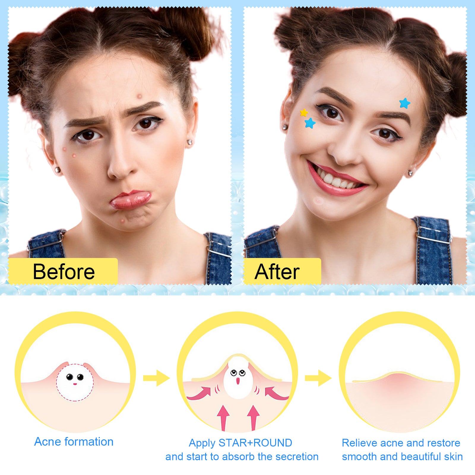 ELAIMEI Stars + Round Pimple Patches, pack of 126pcs (yellow, blue)