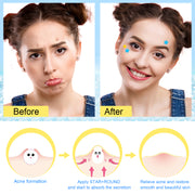 ELAIMEI Stars + Round Pimple Patches, pack of 126pcs (yellow, blue)