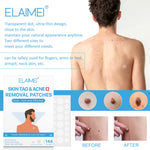 ELAIMEI Patches for Skin Tag & Acne Removal, 144pcs