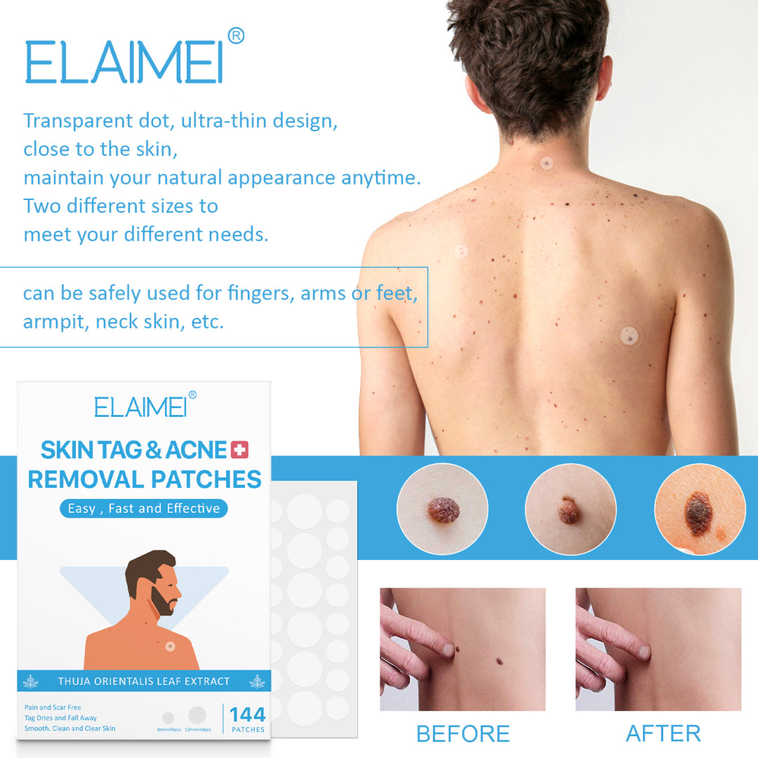 ELAIMEI Patches for Skin Tag & Acne Removal, 144pcs