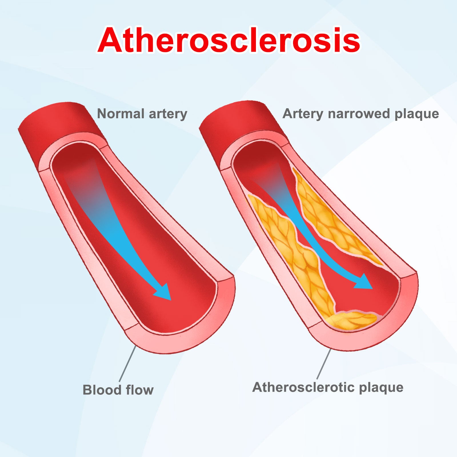 SEFUDUN Diabetes Control Patches, 6pcs