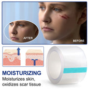 ALIVER Silicone Scar Removal Sheet, 1.5m