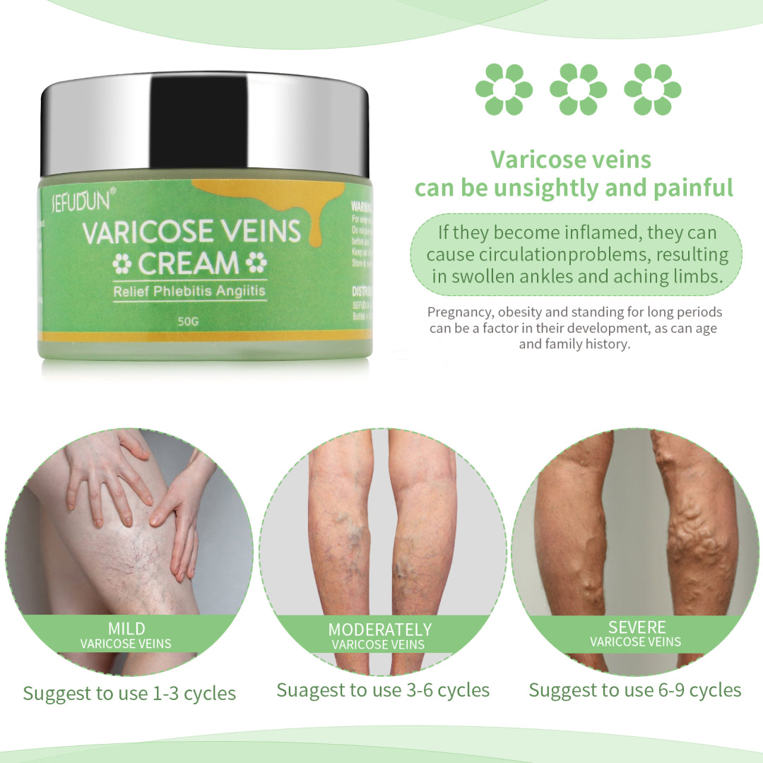 SEFUDUN Varicose Veins Cream, 50g