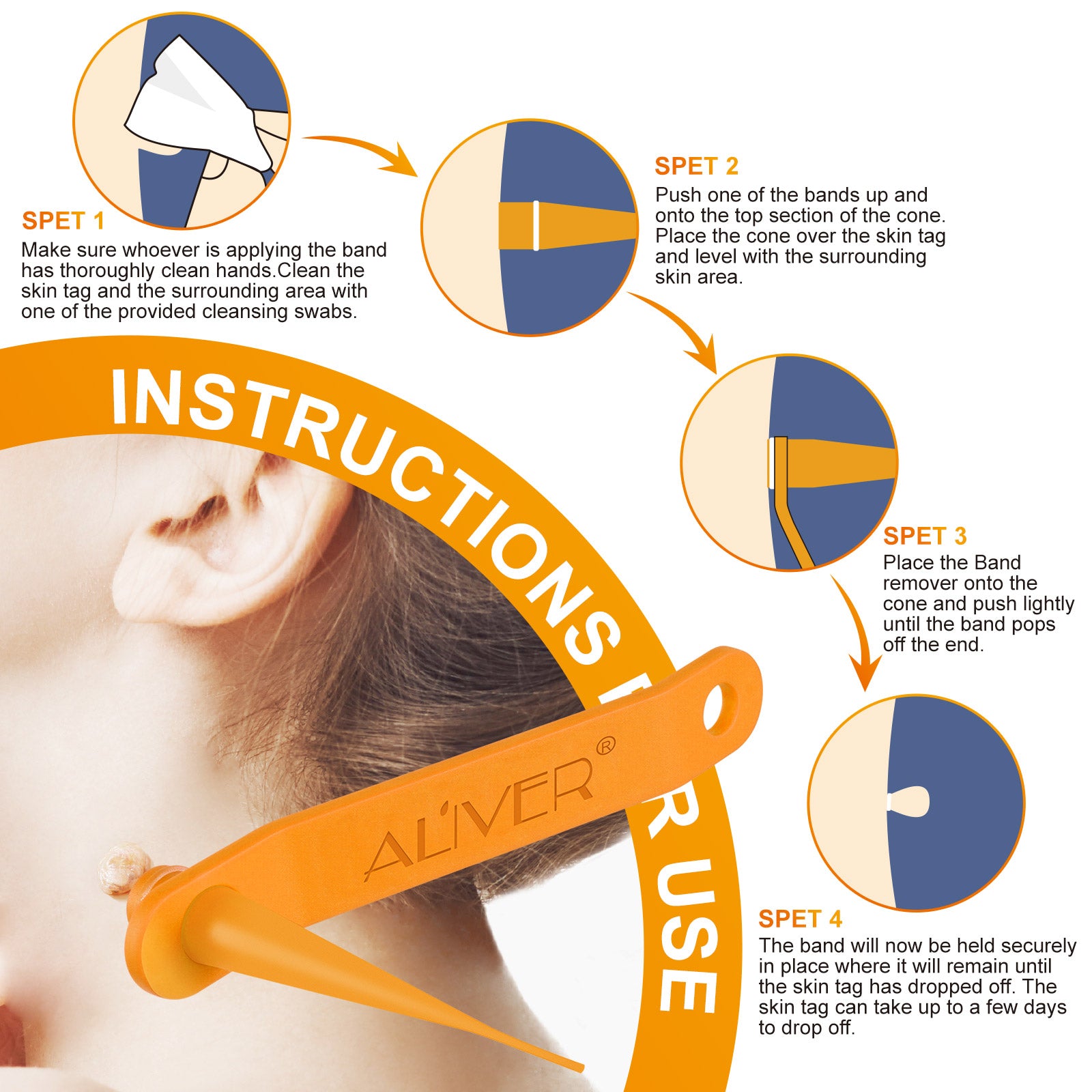 ALIVER Orange Skin Tag Remover Kit