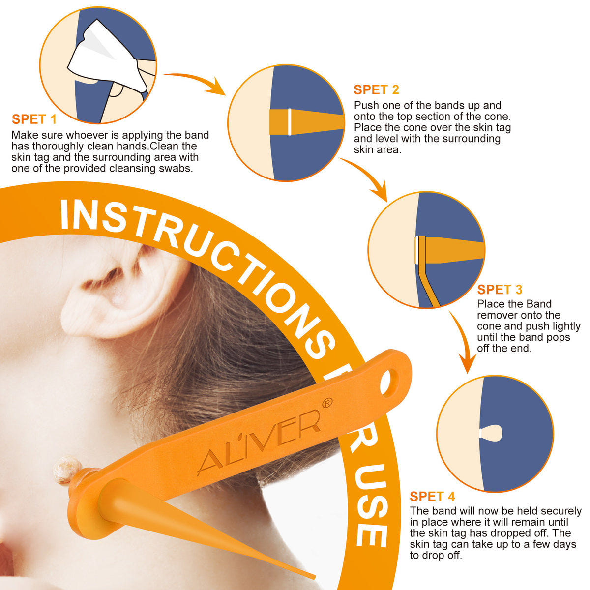ALIVER Orange Skin Tag Remover Kit