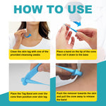 ELAIMEI 2in1 Fast & Effective Skin Tag Remover Kit