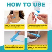 ELAIMEI 2in1 Fast & Effective Skin Tag Remover Kit