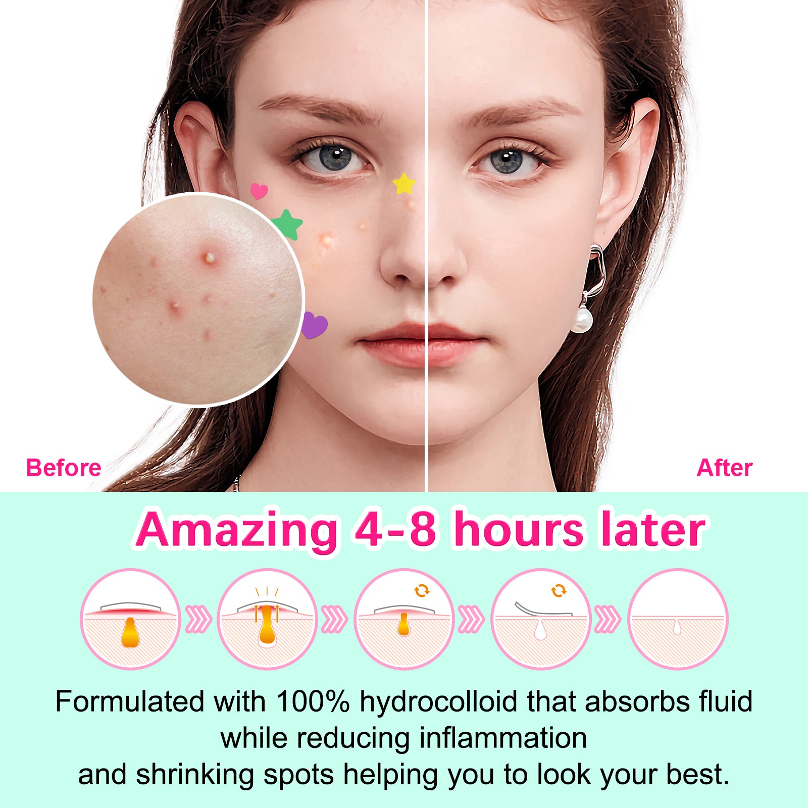 ELAIMEI Stars + Heart Pimple Patches, pack of 156pcs