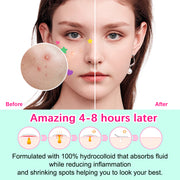 ELAIMEI Stars + Heart Pimple Patches, pack of 156pcs