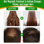 ALIVER Natural Batana Oil for Hair Growth, Skin & Body, 60ml