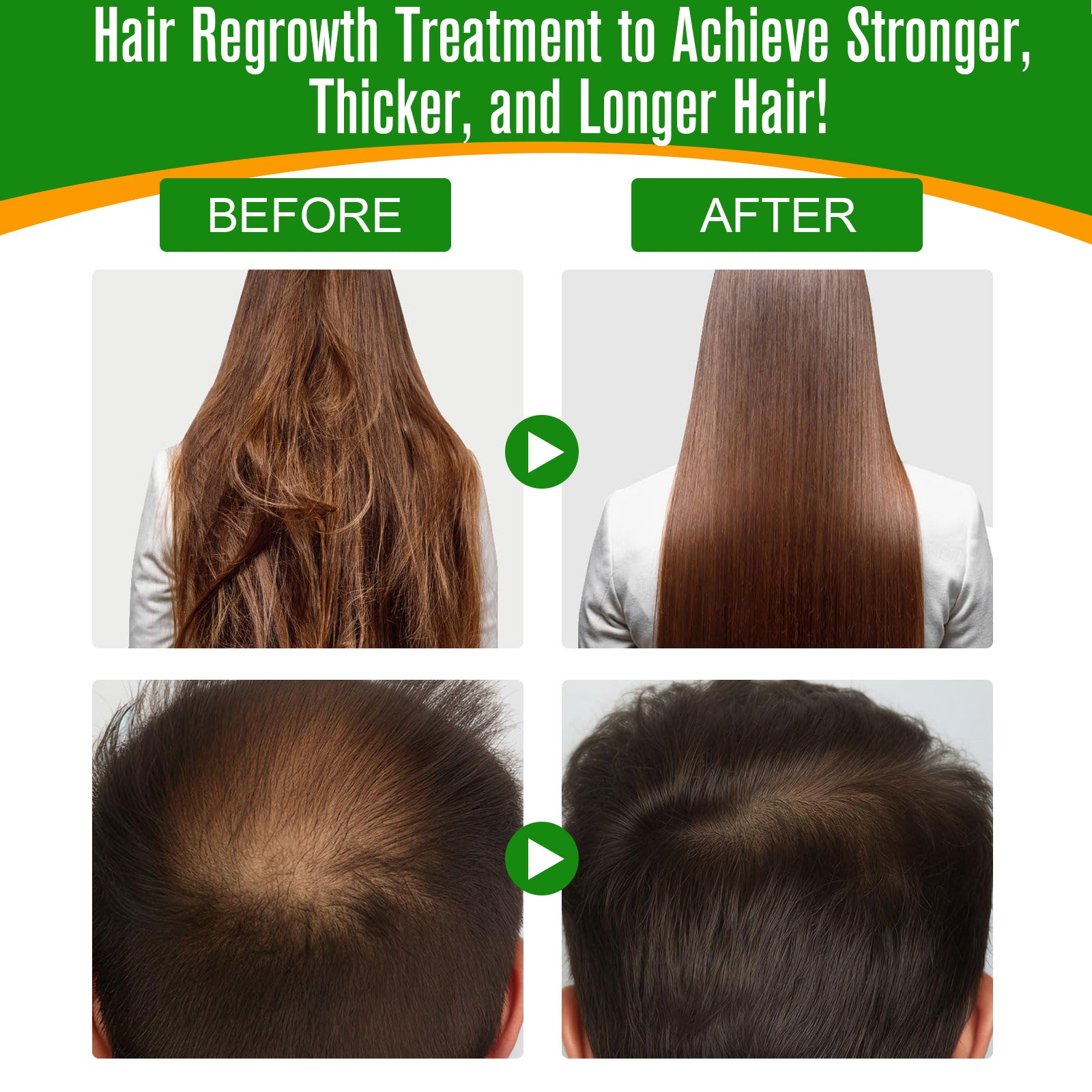 ALIVER Natural Batana Oil for Hair Growth, Skin & Body, 60ml