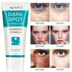 Aliver Dark Spot Remover Corrector Brighter for Face Body Skin Cream